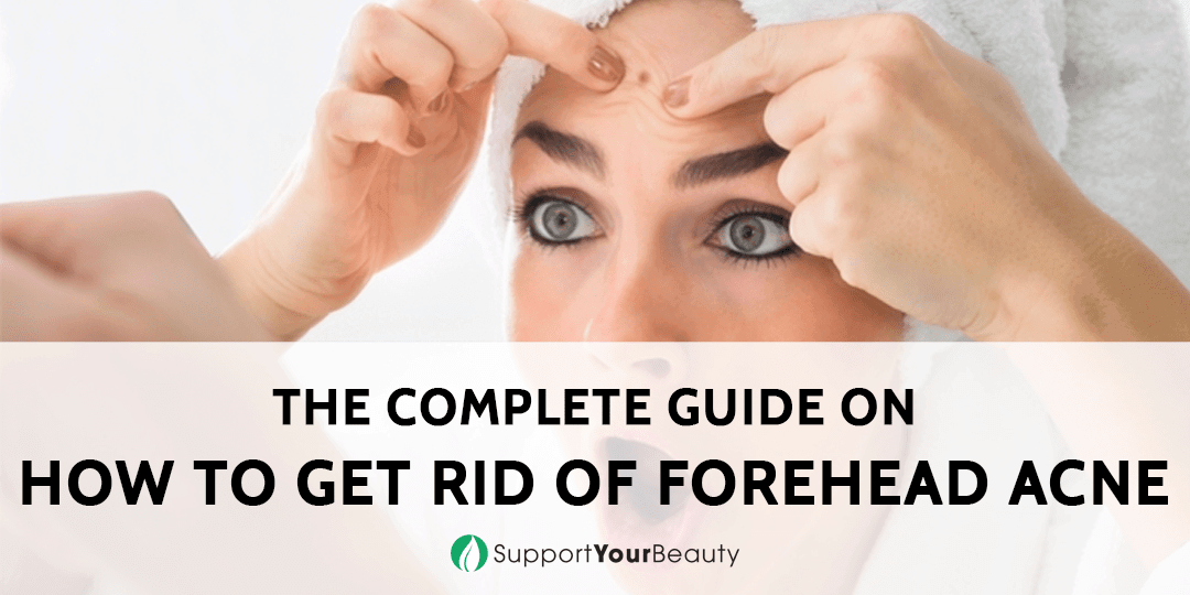 how-to-get-rid-of-forehead-acne-just-updated-2018